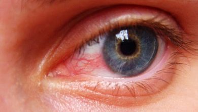 Eyes Problems Connected With Uveitis Disease